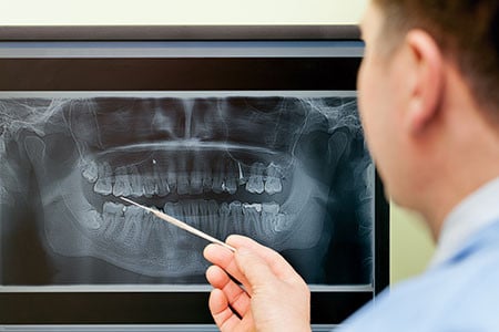 photo of a person looking at an x-ray